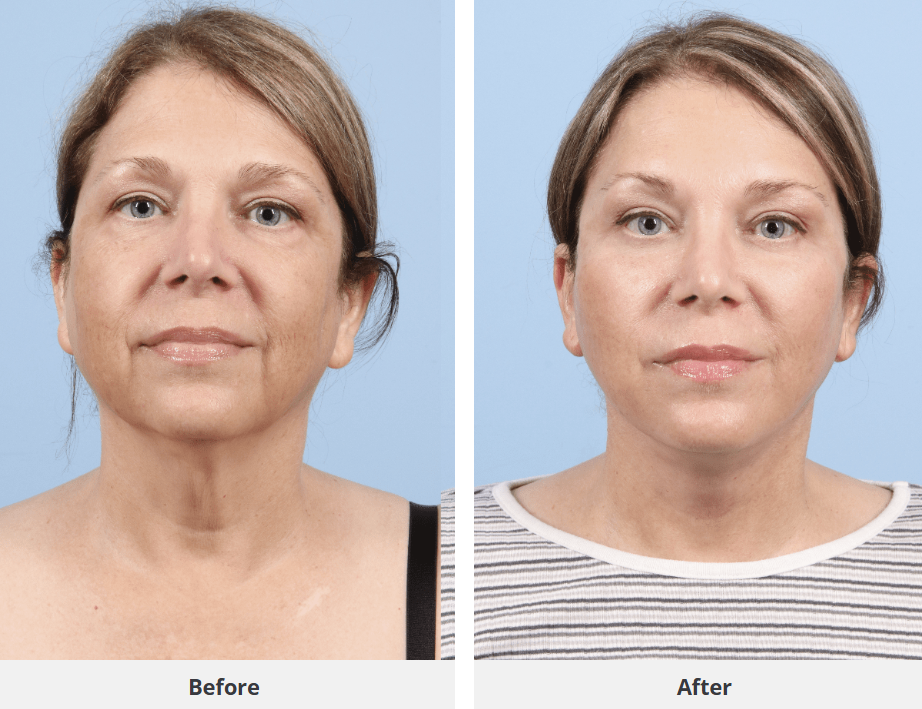 Patient result