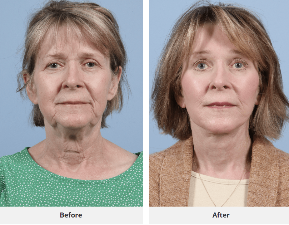 Patient result