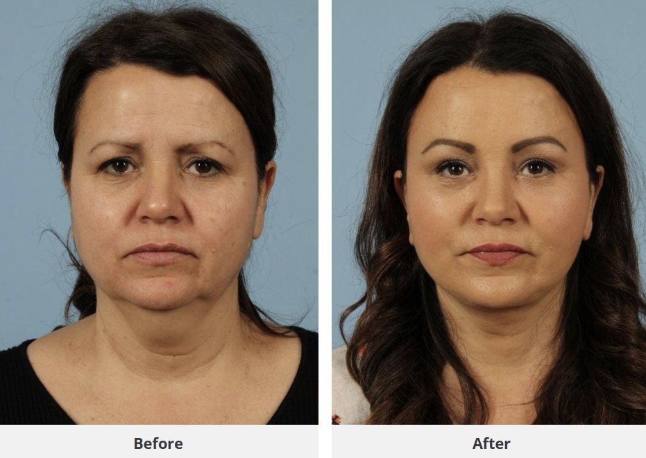Patient result