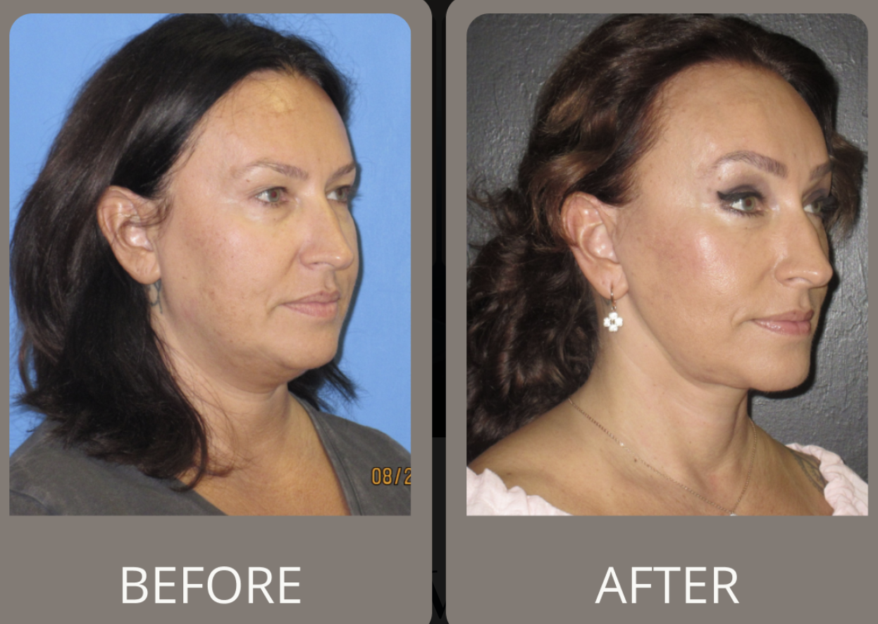 Patient result