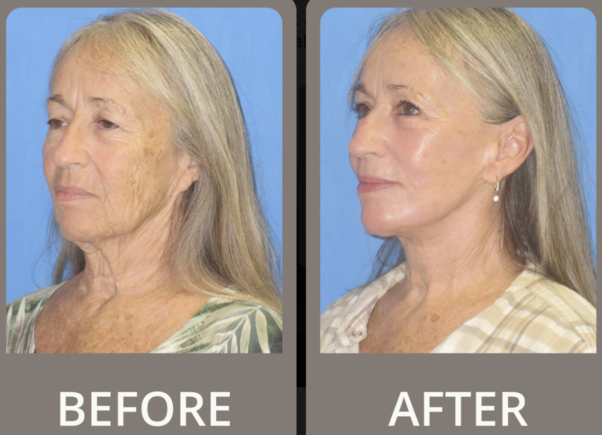 Patient result