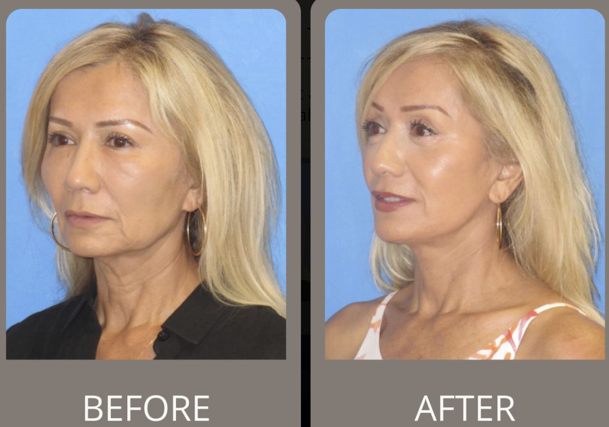 Patient result