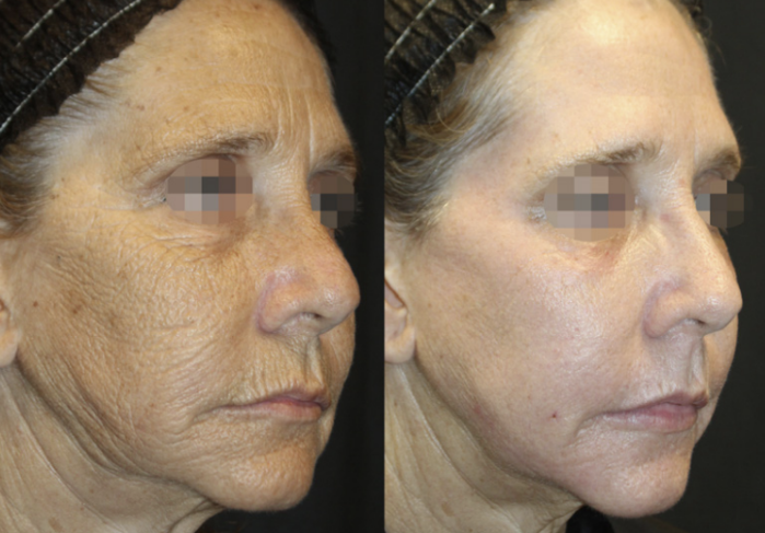 Patient result