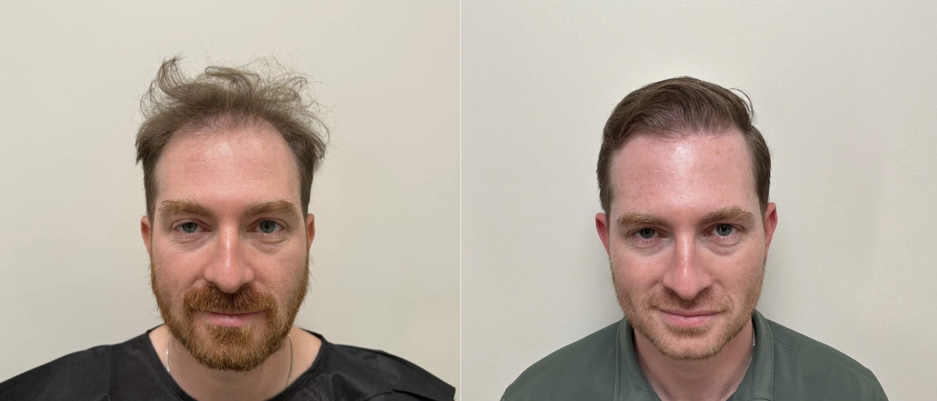 Patient result