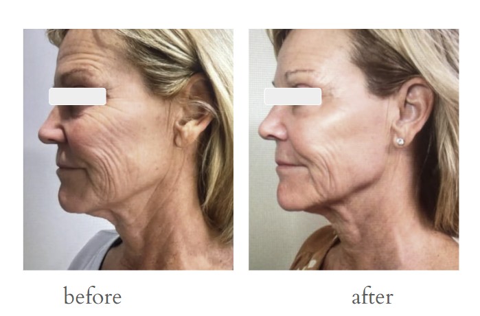 Patient result