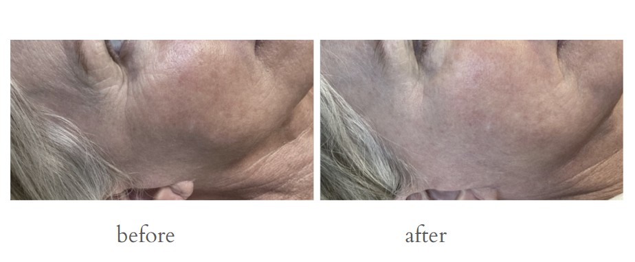 Patient result