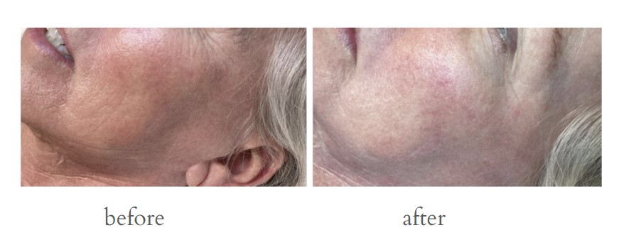 Patient result