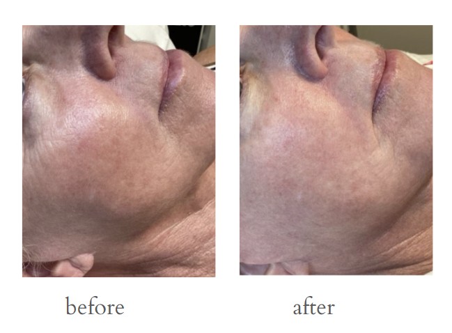 Patient result