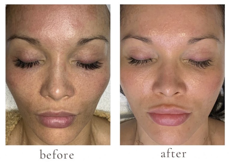 Patient result
